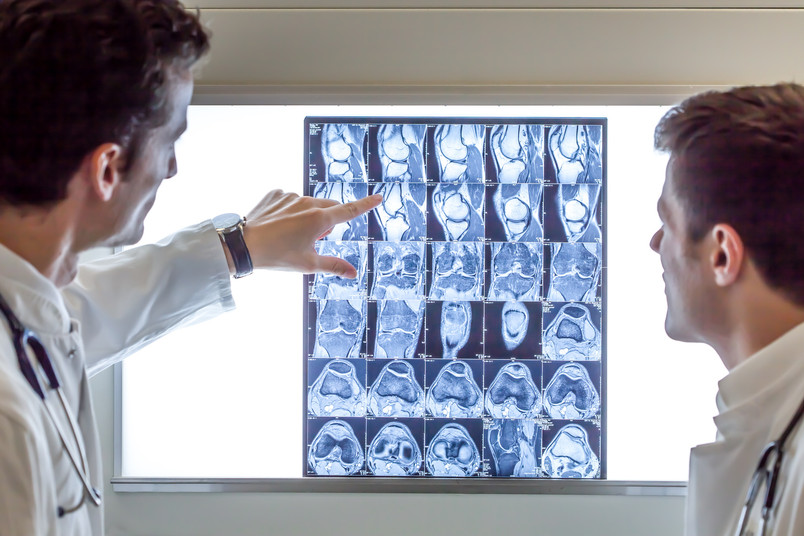 Ärzte betrachten Röntgenbild